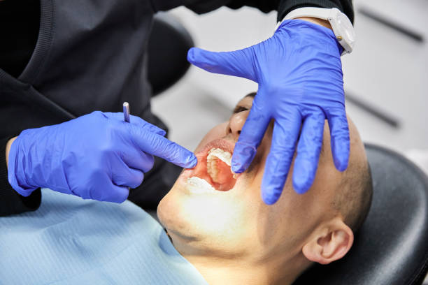 Best Broken or Chipped Tooth Repair in Lake Hamilton, FL
